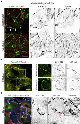 Coronin 1B Controls Endothelial Actin Dynamics at Cell–Cell Junctions and Is Required for Endothelial Network Assembly